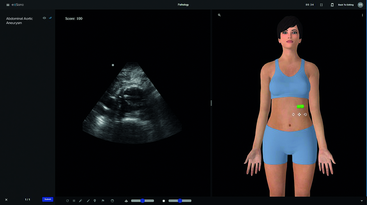 eSono Ultrasound image